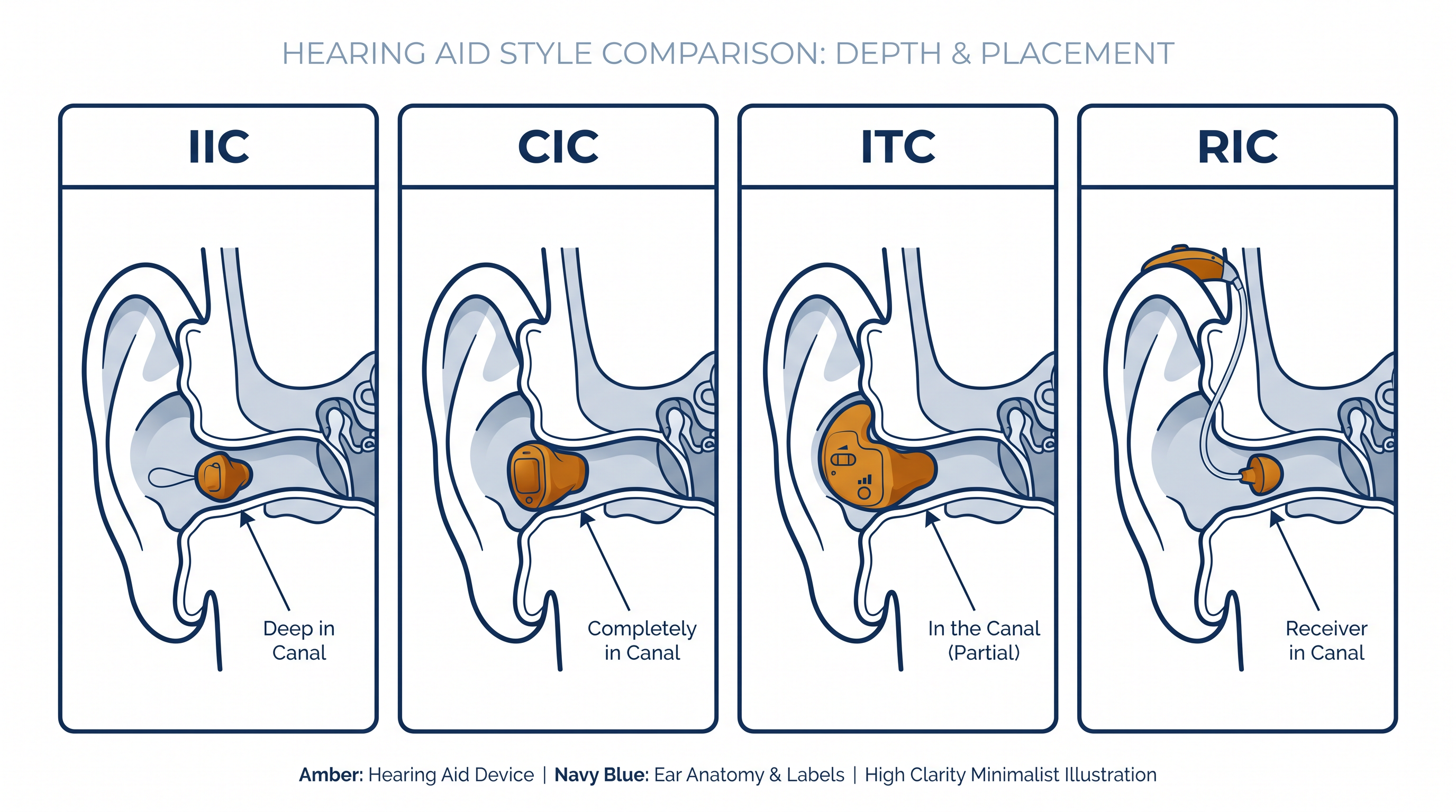 Diagram comparing IIC, CIC, ITC and RIC hearing aid styles in the ear